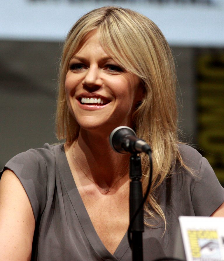 Kaitlin Olson Plastic Surgery Before And After Net Worth In 2021 7375